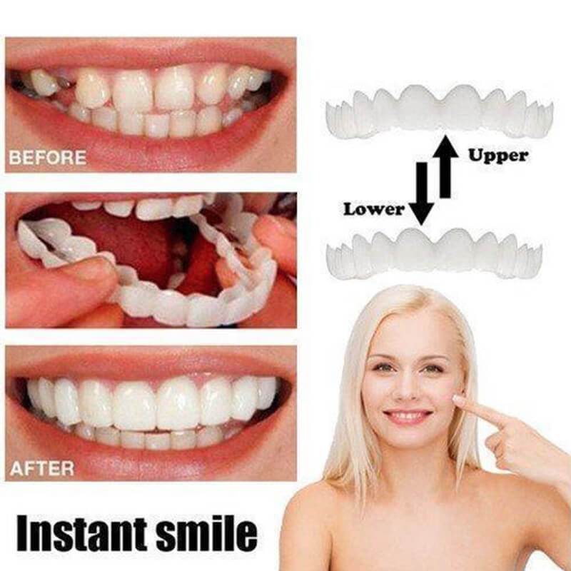 INSTANT SMILE VENEER -Upper & Lower Include