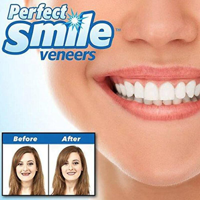 INSTANT SMILE VENEER -Upper & Lower Include