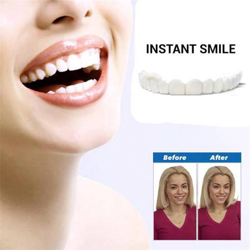 INSTANT SMILE VENEER -Upper & Lower Include