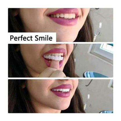 INSTANT SMILE VENEER -Upper & Lower Include