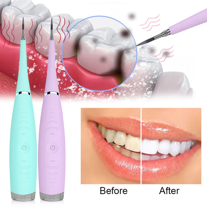 Electric ultrasonic tooth cleaning machine tooth stone removal agent